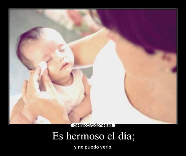 Es hermoso el día; - y no puedo verlo.