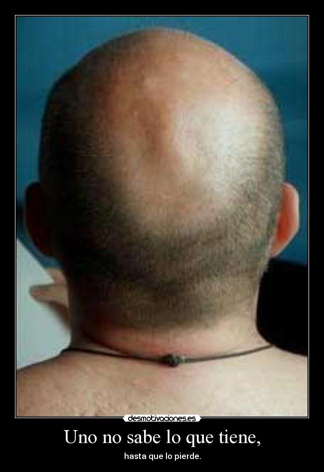 Uno no sabe lo que tiene, - hasta que lo pierde.