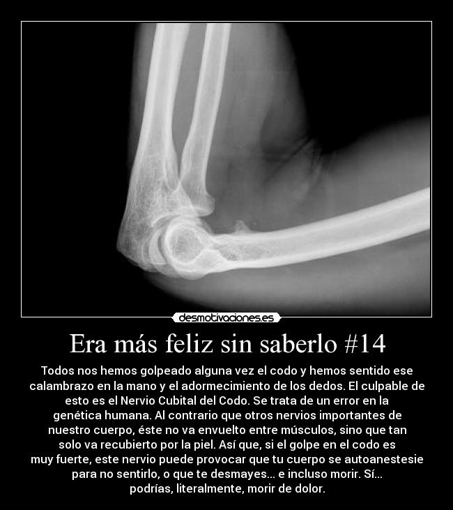 Era más feliz sin saberlo #14 - Todos nos hemos golpeado alguna vez el codo y hemos sentido ese
calambrazo en la mano y el adormecimiento de los dedos. El culpable de
esto es el Nervio Cubital del Codo. Se trata de un error en la
genética humana. Al contrario que otros nervios importantes de
nuestro cuerpo, éste no va envuelto entre músculos, sino que tan
solo va recubierto por la piel. Así que, si el golpe en el codo es
muy fuerte, este nervio puede provocar que tu cuerpo se autoanestesie
para no sentirlo, o que te desmayes... e incluso morir. Sí...
podrías, literalmente, morir de dolor.