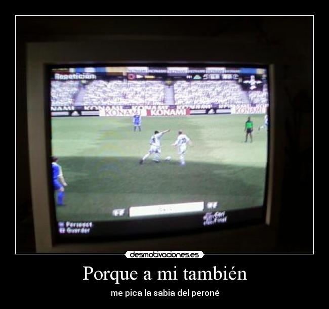 Porque a mi también - me pica la sabia del peroné