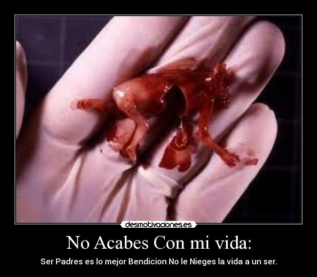 No Acabes Con mi vida: - Ser Padres es lo mejor Bendicion No le Nieges la vida a un ser.