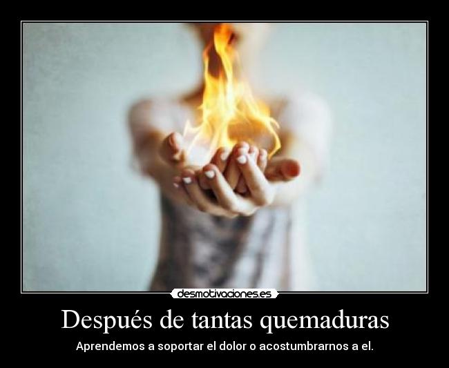 Después de tantas quemaduras -