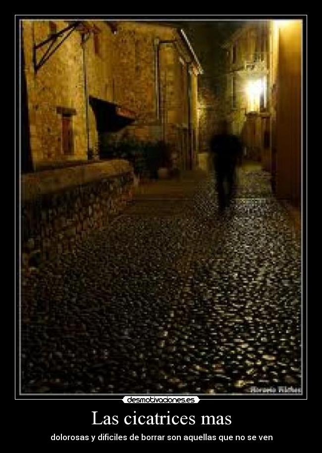 Las cicatrices mas - dolorosas y dificiles de borrar son aquellas que no se ven