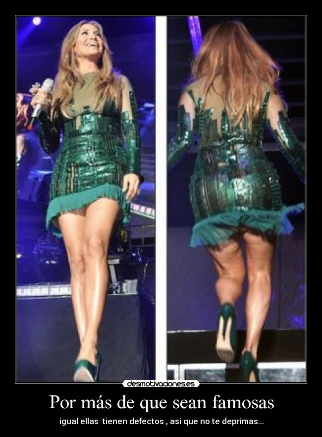 Por más de que sean famosas - igual ellas tienen defectos , asi que no te deprimas...