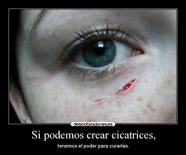 Si podemos crear cicatrices, - 