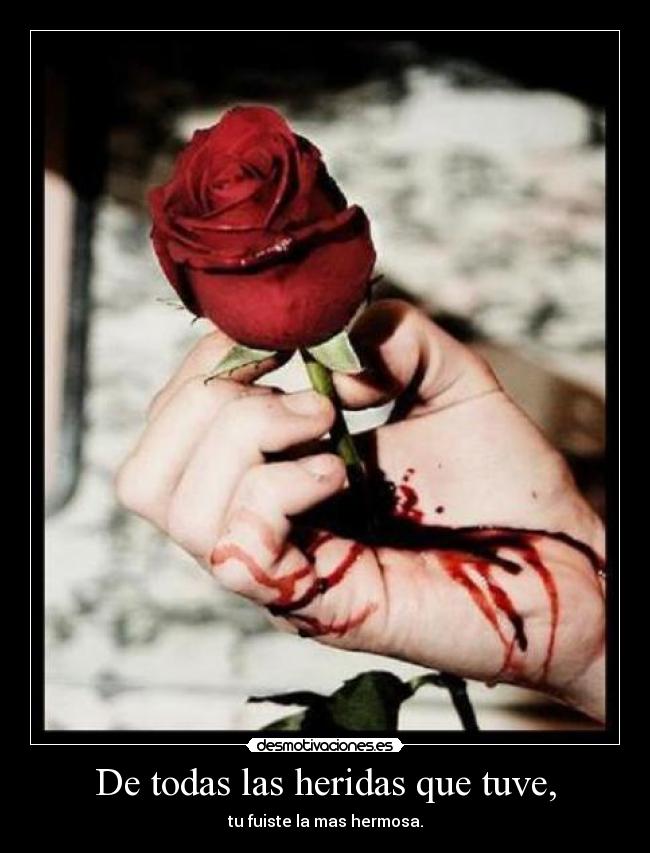 De todas las heridas que tuve, - tu fuiste la mas hermosa.