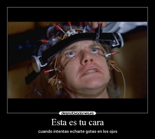 carteles alex delarge naranja mecanica tratamiento ludovico gotas los ojos cara desmotivaciones