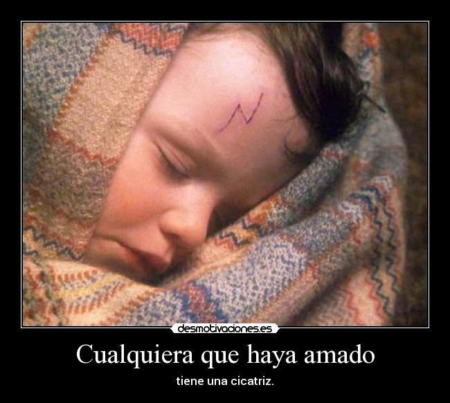 Cualquiera que haya amado - tiene una cicatriz.