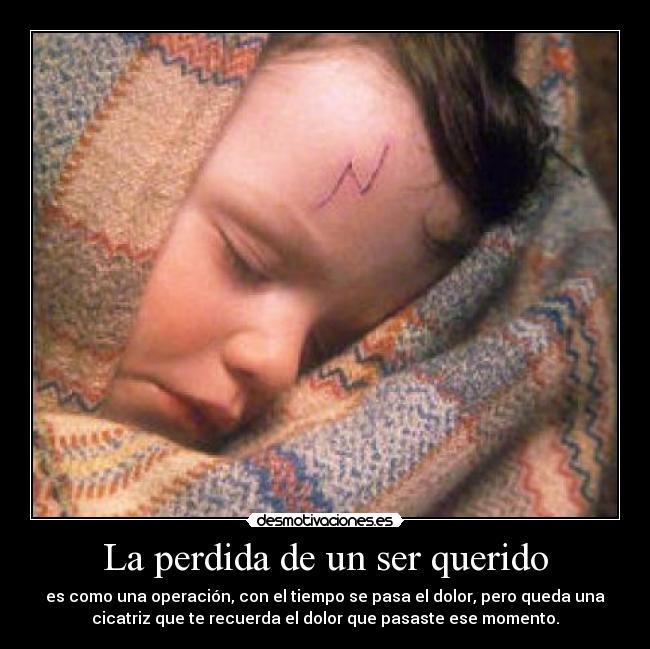 La perdida de un ser querido - es como una operación, con el tiempo se pasa el dolor, pero queda una
cicatriz que te recuerda el dolor que pasaste ese momento.