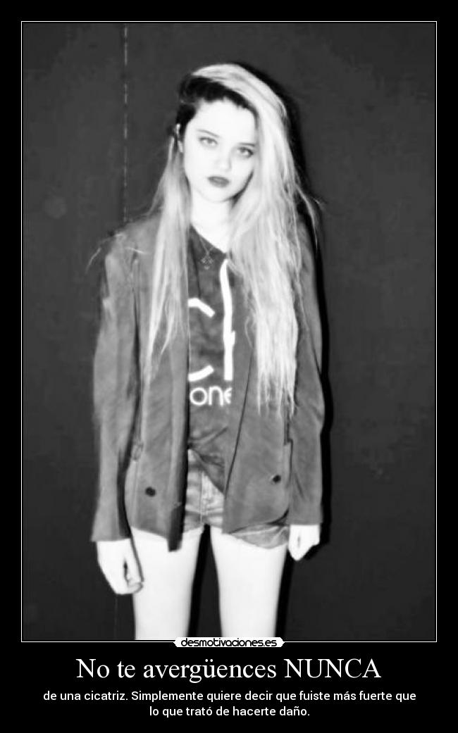 No te avergüences NUNCA - de una cicatriz. Simplemente quiere decir que fuiste más fuerte que
lo que trató de hacerte daño.