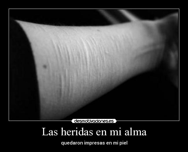 Las heridas en mi alma - 