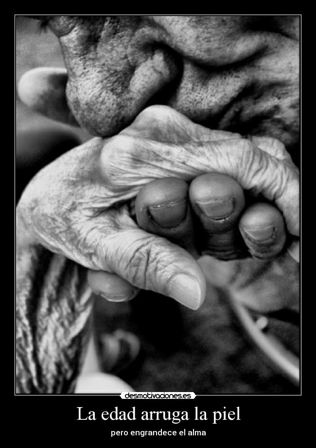 La edad arruga la piel -