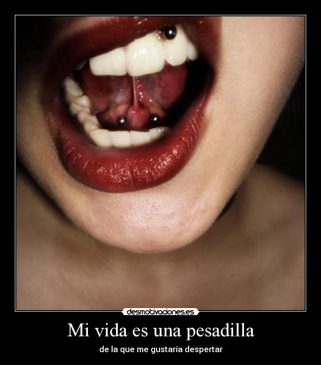 Mi vida es una pesadilla - 