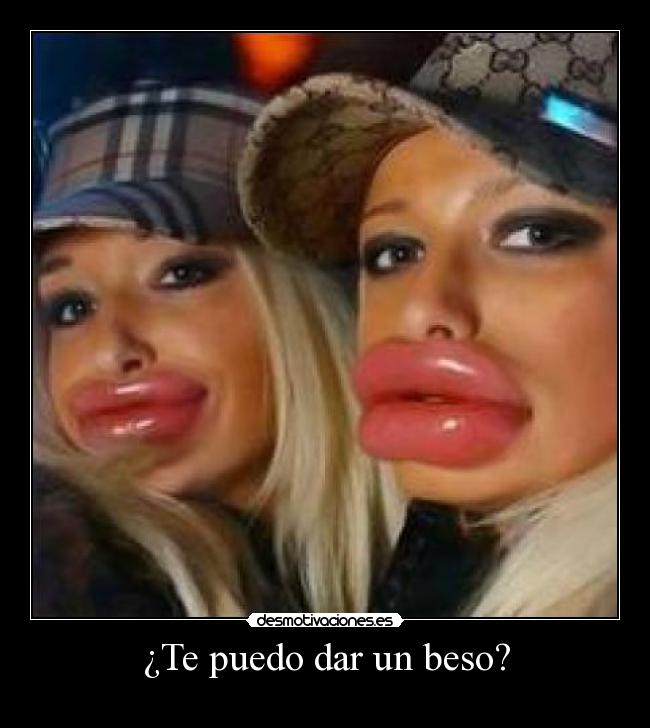 ¿Te puedo dar un beso? -