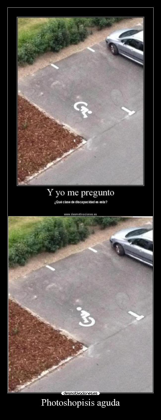 Photoshopisis aguda -