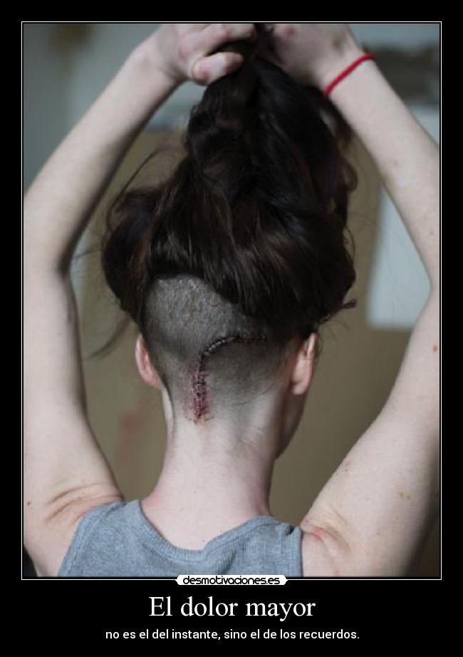 El dolor mayor - 
