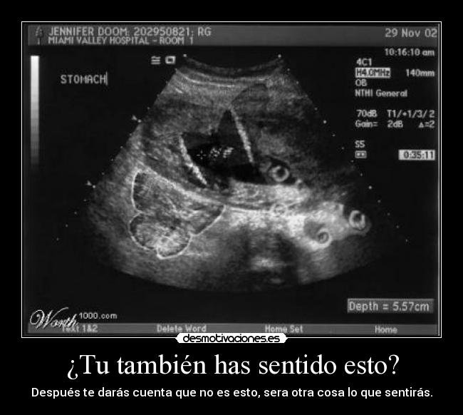 ¿Tu también has sentido esto? - 