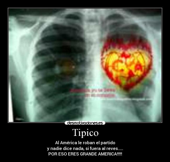 Tipico - Al América le roban el partido
y nadie dice nada, si fuera al reves.....
POR ESO ERES GRANDE AMERICA!!!!!