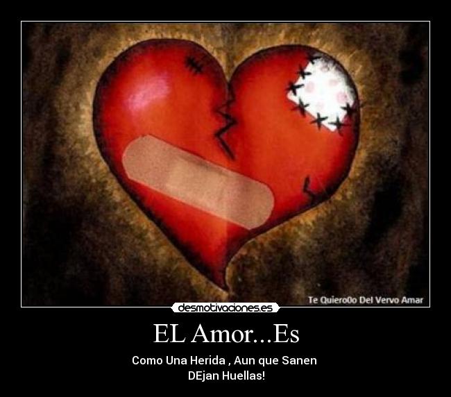 EL Amor...Es - Como Una Herida , Aun que Sanen 
DEjan Huellas!