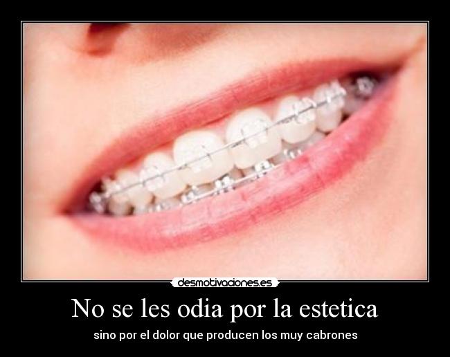 No se les odia por la estetica -