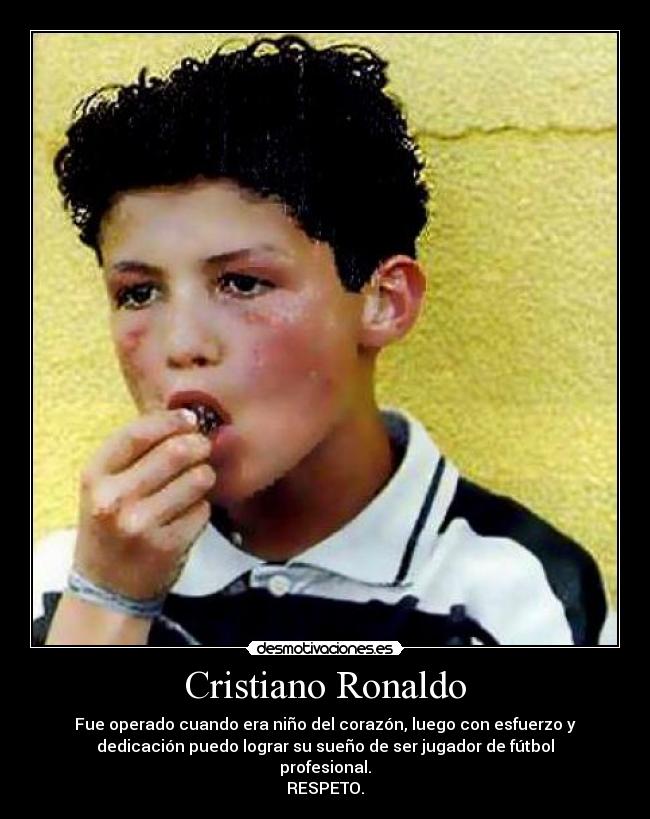 Cristiano Ronaldo - Fue operado cuando era niño del corazón, luego con esfuerzo y
dedicación puedo lograr su sueño de ser jugador de fútbol
profesional.
RESPETO.