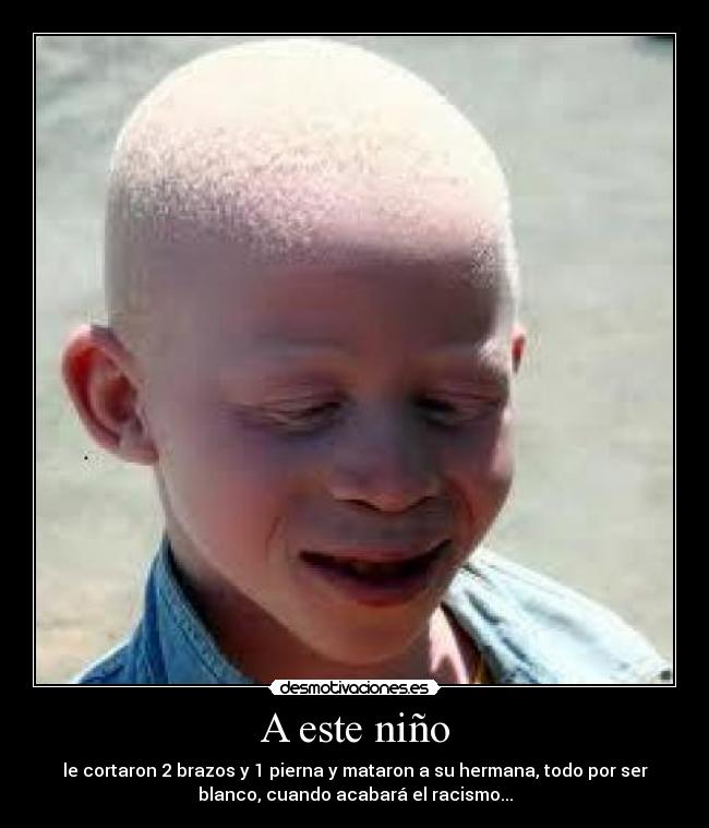 A este niño - 