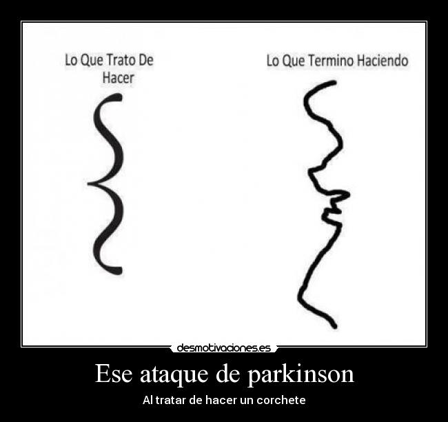 Ese ataque de parkinson - Al tratar de hacer un corchete