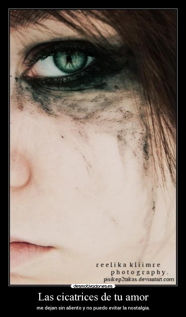 Las cicatrices de tu amor - me dejan sin aliento y no puedo evitar la nostalgia.