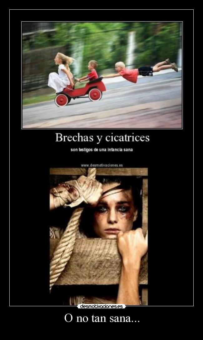 O no tan sana... - 
