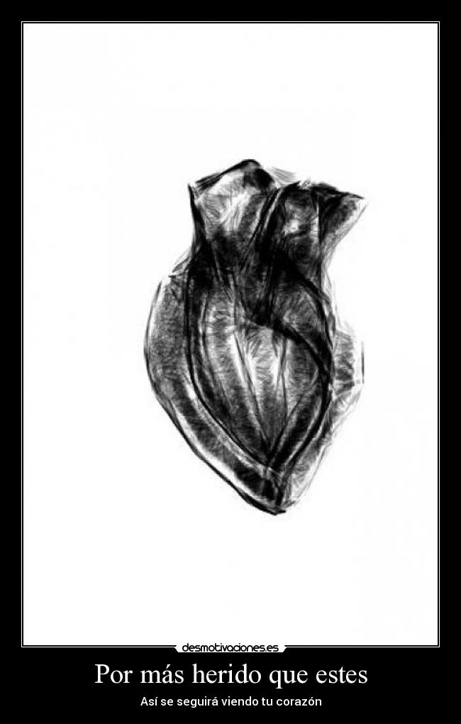 Por más herido que estes - Así se seguirá viendo tu corazón