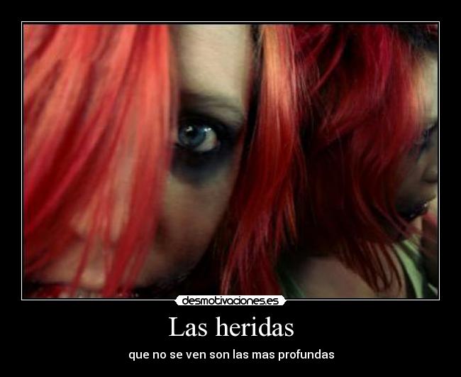 Las heridas - que no se ven son las mas profundas