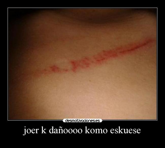 joer k dañoooo komo eskuese -