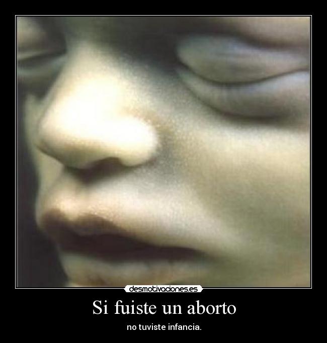 Si fuiste un aborto - no tuviste infancia.