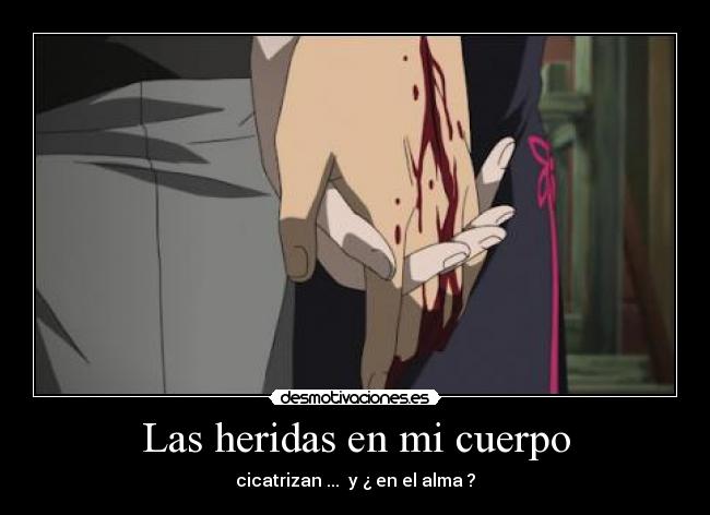 Las heridas en mi cuerpo - 