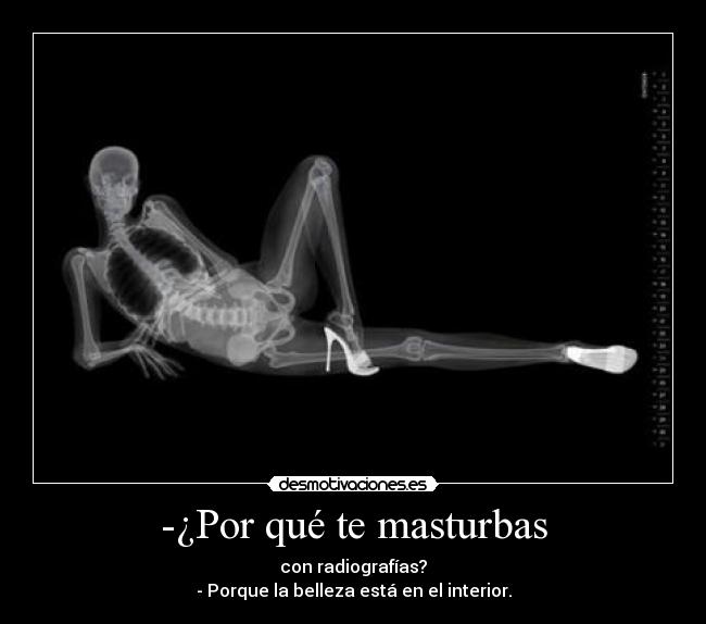 -¿Por qué te masturbas - con radiografías?
- Porque la belleza está en el interior.