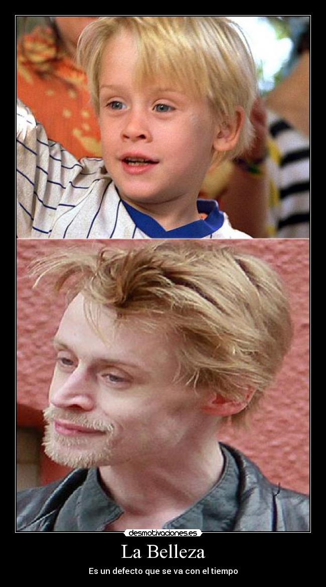 La Belleza - Es un defecto que se va con el tiempo