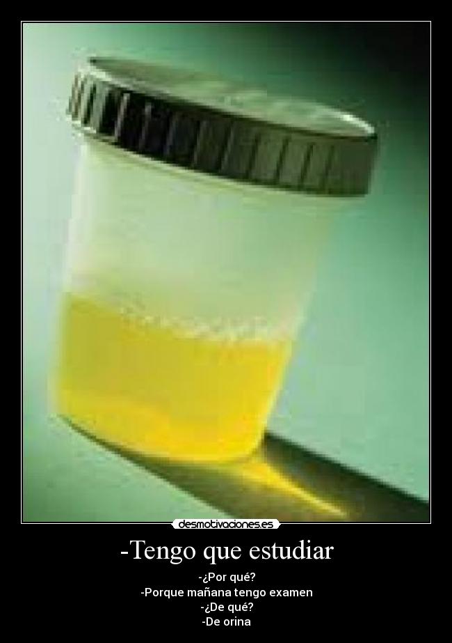 -Tengo que estudiar - -¿Por qué?
-Porque mañana tengo examen
-¿De qué?
-De orina