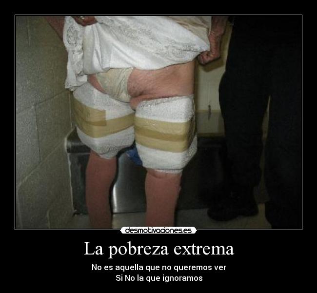 La pobreza extrema - No es aquella que no queremos ver
Si No la que ignoramos