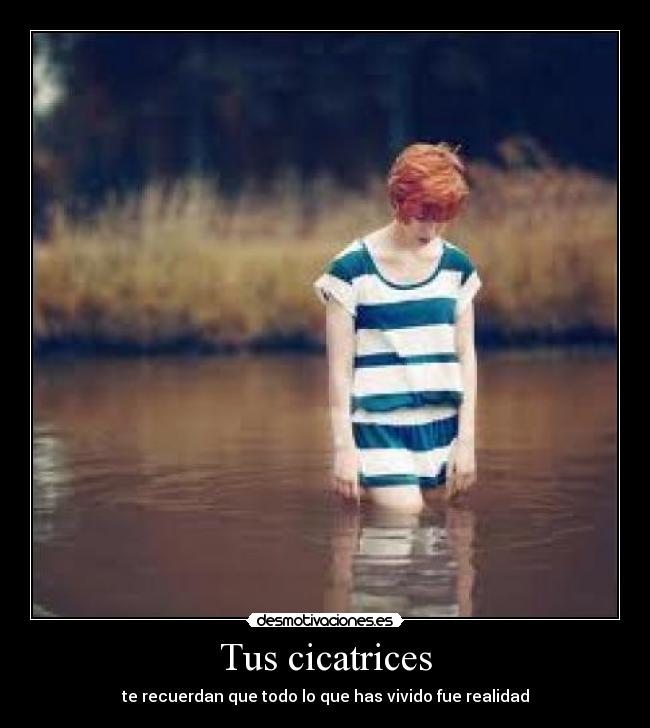 Tus cicatrices - te recuerdan que todo lo que has vivido fue realidad