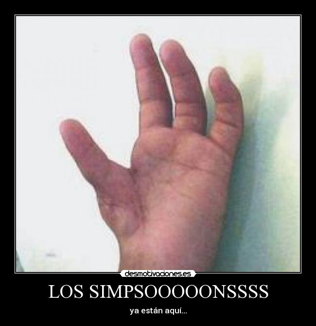 LOS SIMPSOOOOONSSSS - ya están aquí...