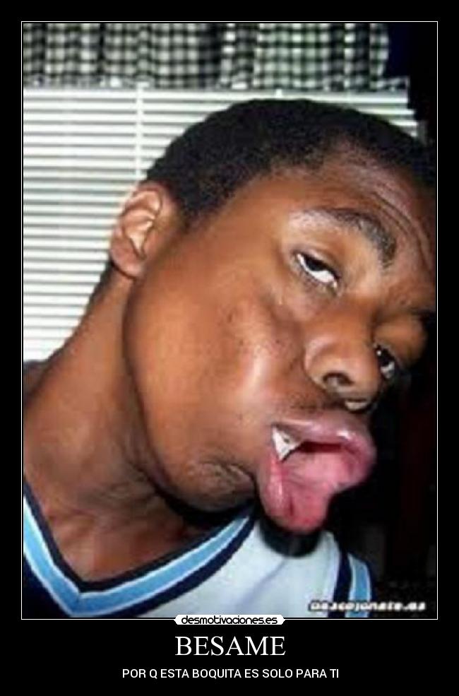 BESAME - POR Q ESTA BOQUITA ES SOLO PARA TI