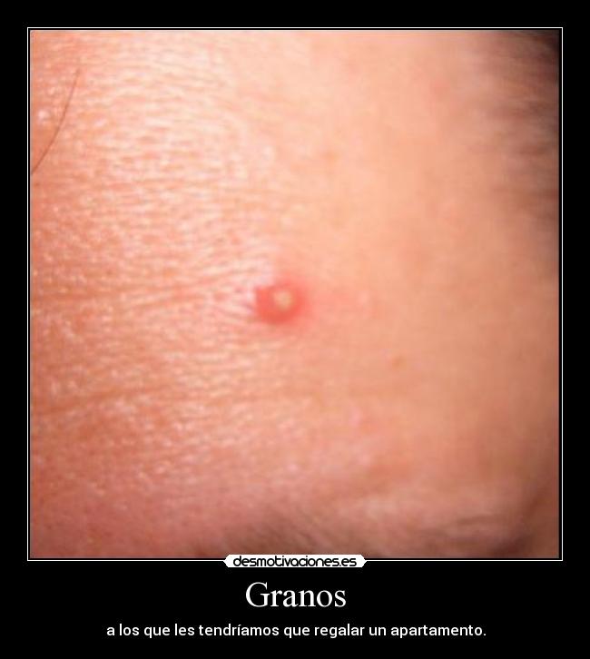 Granos - 