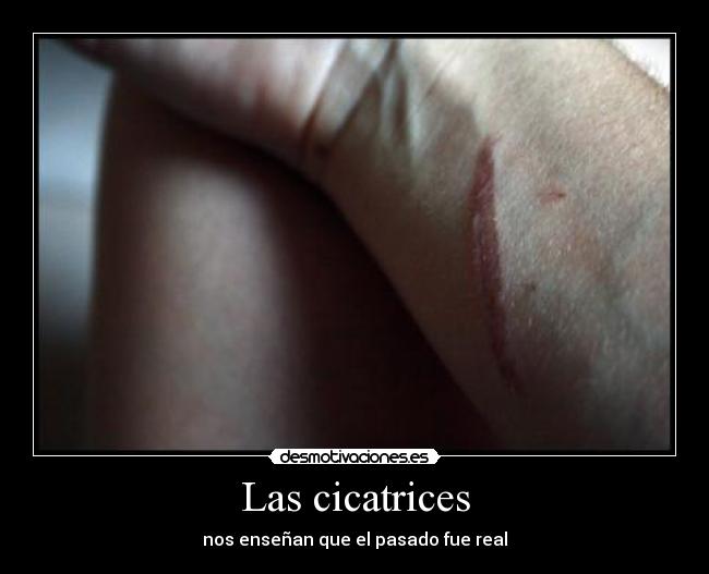 Las cicatrices -