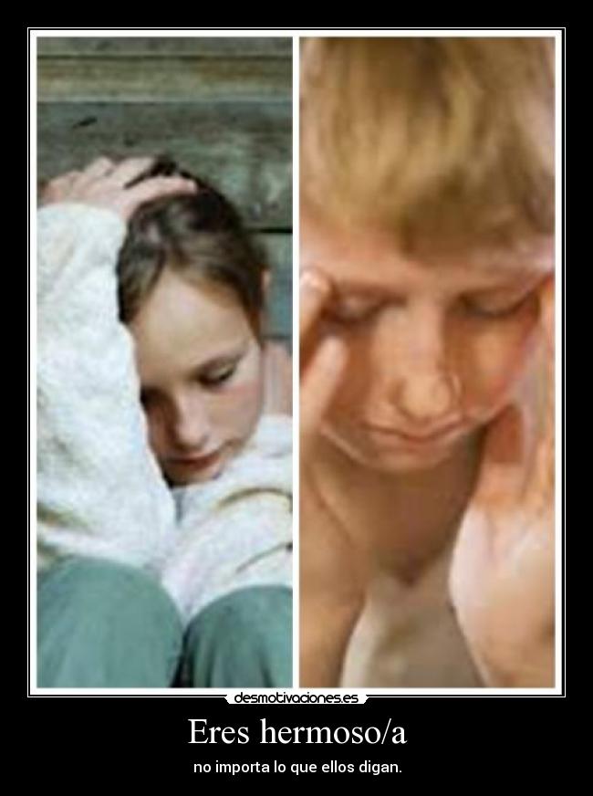 Eres hermoso/a - no importa lo que ellos digan.