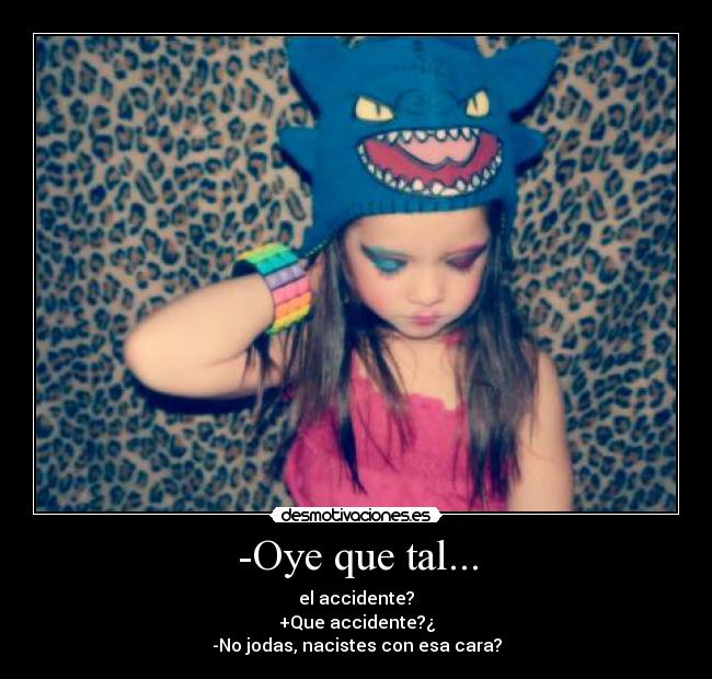 -Oye que tal... - el accidente?
+Que accidente?¿
-No jodas, nacistes con esa cara?