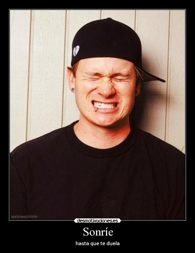 Sonríe - hasta que te duela