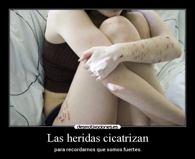 Las heridas cicatrizan - para recordarnos que somos fuertes.