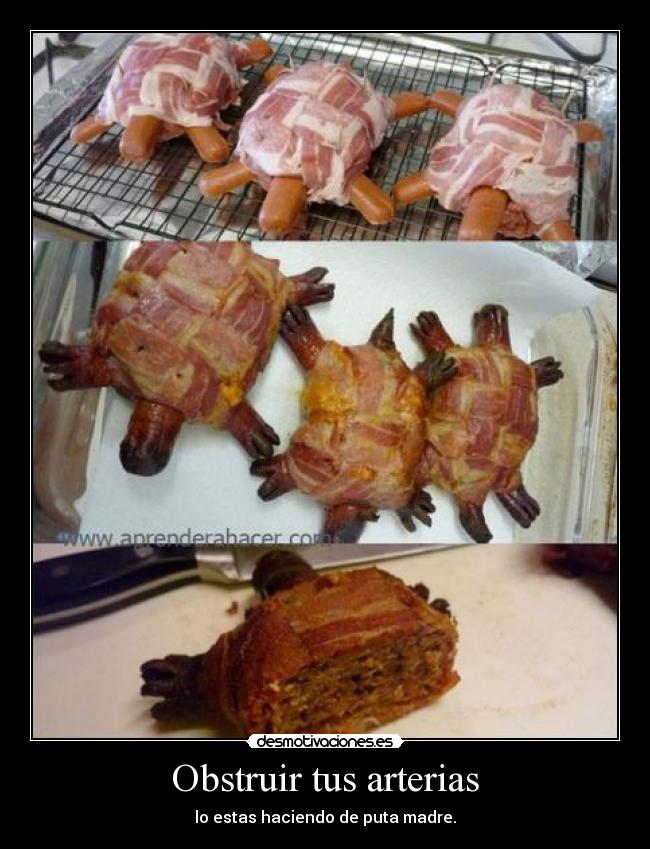 Obstruir tus arterias - lo estas haciendo de puta madre.