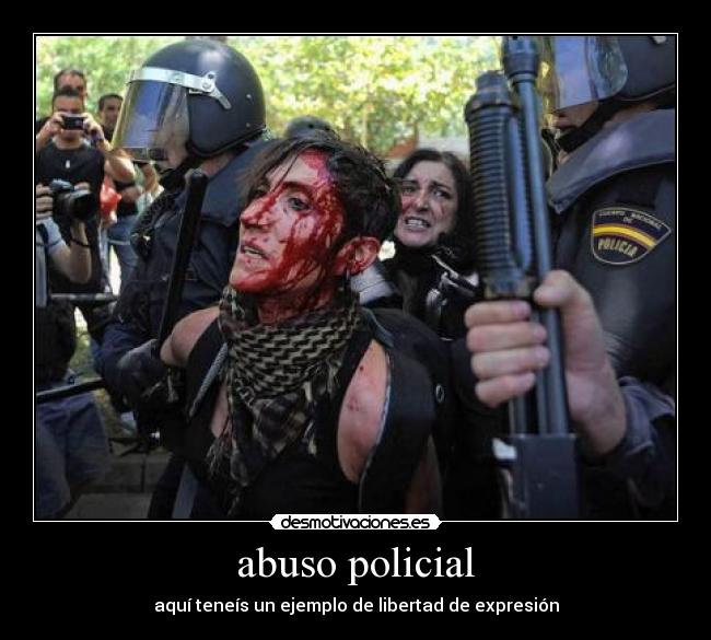 abuso policial - 