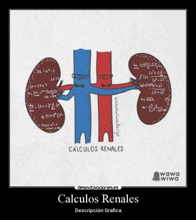 Calculos Renales - Descripción Grafica